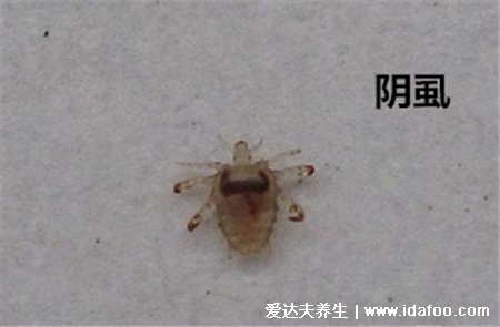 阴虱最怕什么，女性阴虱虫子图片(怕碘酒/硫磺皂/阳光)