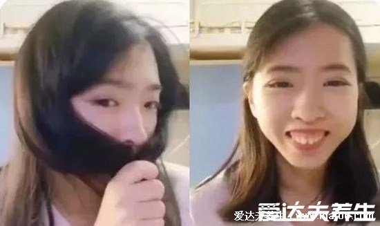 5类人不能做牙齿整形，成年以后千万别整牙纯属误导(急性传染病不能)