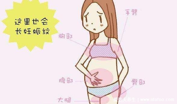 产后真实妊娠纹图片，有腿部腹部早期图片(紫色红色变为白色)