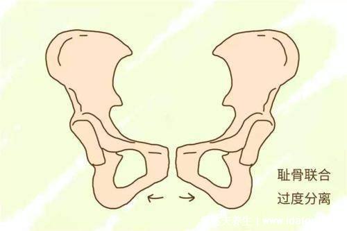 耻骨是哪个部位图片，孕期中晚期女性容易耻骨疼