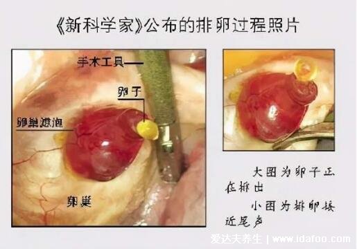 卵子是什么样的图片，直径1.8-2.5cm球形细胞(卵巢不排卵可不孕)