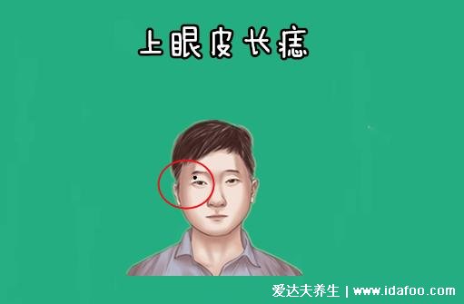 面部哪些痣必须点掉，人中痣和上眼皮的痣(4种痣不吉利)