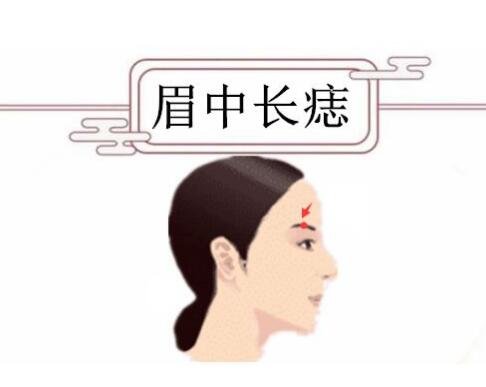 女人身上的10大福痣少见的极富贵痣，屁股有痣财运事业佳