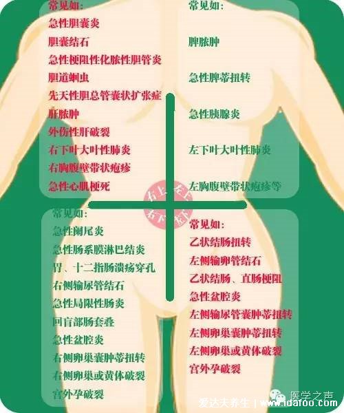 女性下腹疼痛部位图解，右下腹疼痛是阑尾炎