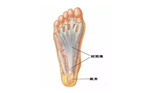女性足底筋膜炎4个痛点图片，跟骨内上方最严重(3种止疼方法)