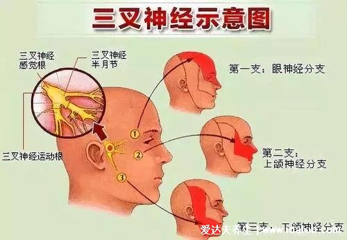 人体三叉神经痛是哪个部位图解，牙齿和鼻翼可能疼(女性更易得)