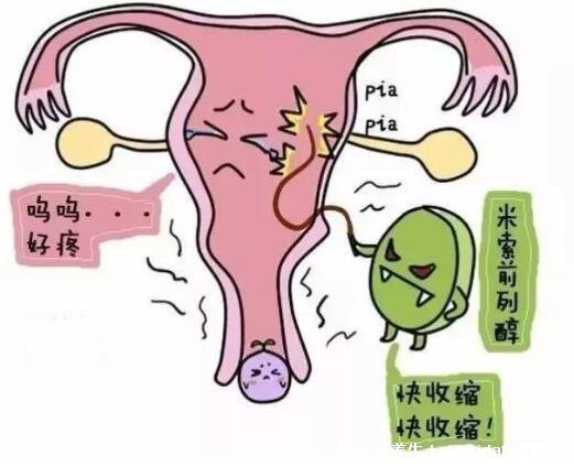 伤害最小的流产方式，药流相对人流损伤小(适用停经49天内) 