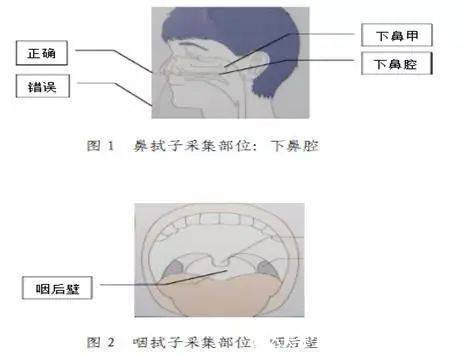 为什么要做鼻拭子不做咽拭子，鼻拭子准确率更高(都能有效检测)