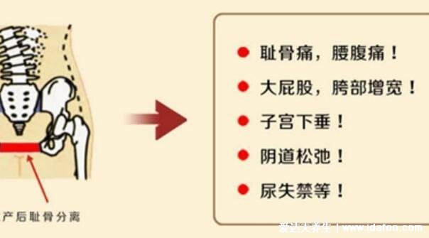 孕妇耻骨在哪个位置示意图片，大腿跟内侧有骨头的地方(附缓解法)