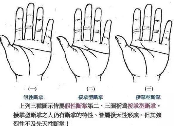 真正的断掌纹图片，3种断掌有不同的运势(假性断掌)