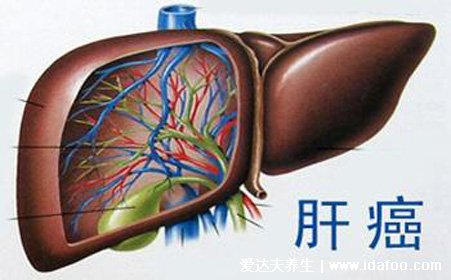 最难治的肿瘤排名，胰腺癌是癌症之王