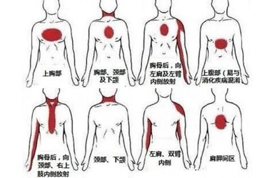 后背疼痛要警惕的三种病，警惕颈椎病/风湿病/心脏问题