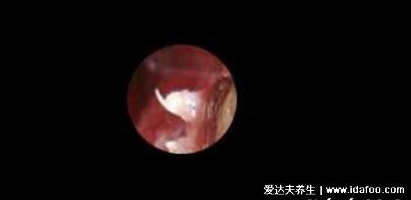 不要轻易做HPV和TCT检查为谣言，及时发现病毒感染和宫颈病变