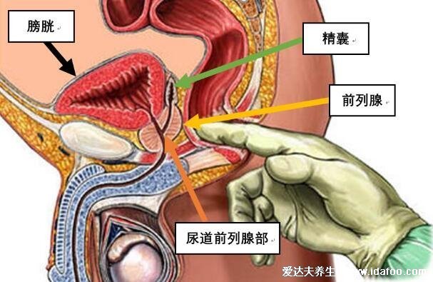 如何判断自己前列腺炎，50%的男性会患病可对比症状自测 