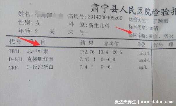 婴儿30天黄疸值对照表，足月新生儿正常值低于12.9(早产儿15)