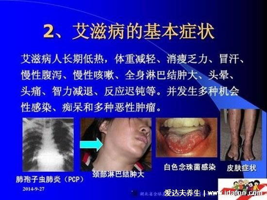 世界上十大必死病图片，狂犬病病死率接近100%(心脑血管死亡率高)