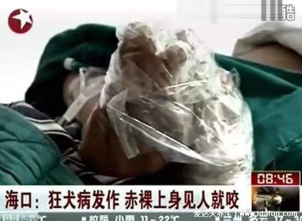 世界上十大必死病图片，狂犬病病死率接近100%(心脑血管死亡率高)