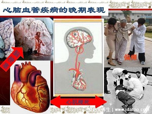 世界上十大必死病图片，狂犬病病死率接近100%(心脑血管死亡率高)