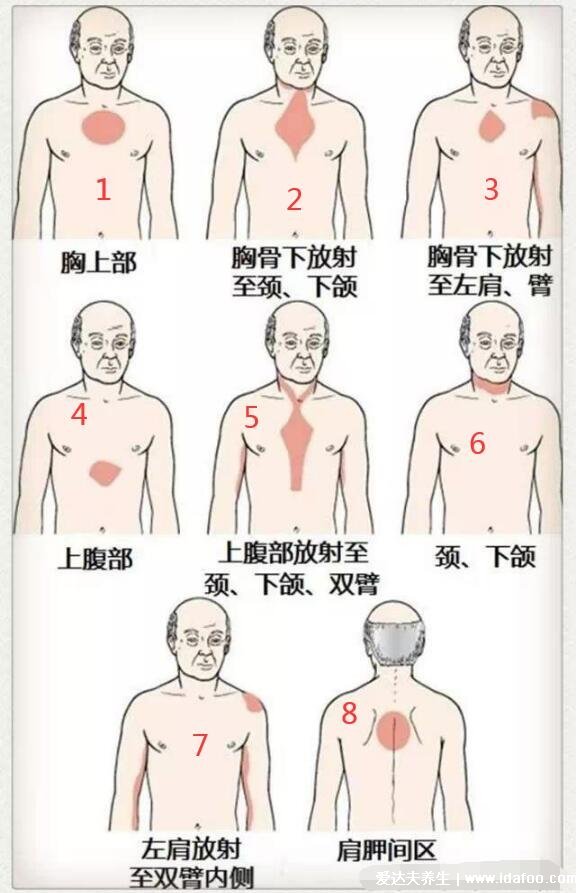 心脏不好早期10个征兆，需要垫高枕头才好入睡要引起注意