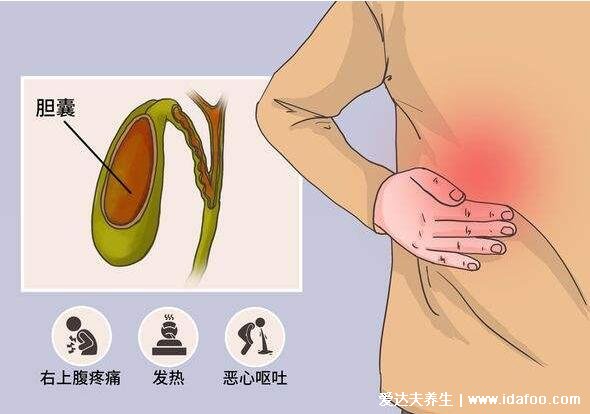 胆囊炎症状疼痛位置图，右上腹疼痛饮食油腻后可加重(女性要注意)