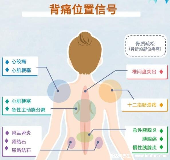 背部筋膜炎疼痛位置图，身体背部各部位疼痛对照图