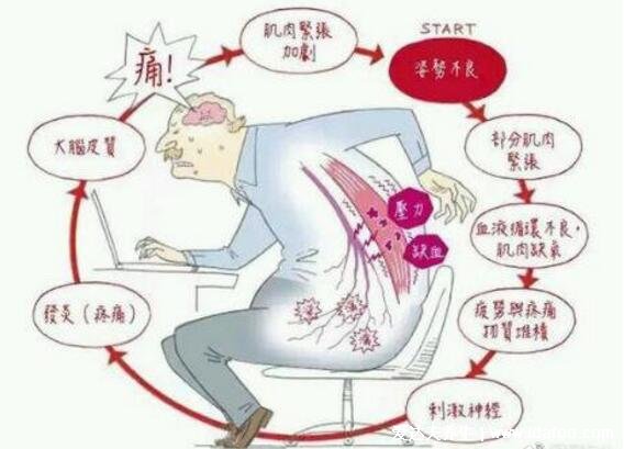 背部筋膜炎疼痛位置图，身体背部各部位疼痛对照图