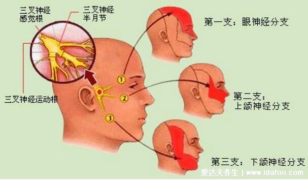 三叉神经痛是哪个部位图解，面部口腔下颌中某一点的剧烈抽痛