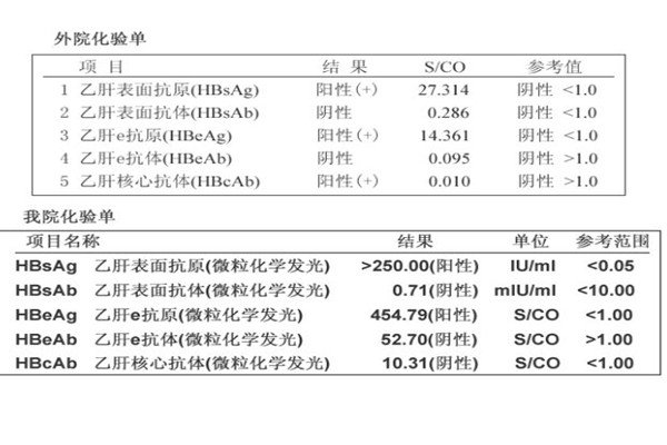 乙肝五项正常结果图，三项指标呈阳性说明了什么