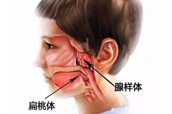 切除腺样体后悔到家了，别急着手术影响孩子的发育和免疫力