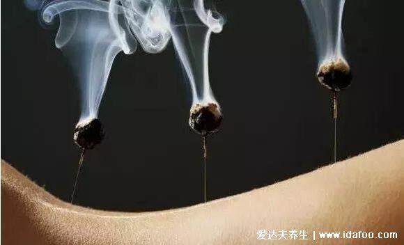 艾灸后怎么看湿气排出，除水泡还有这四个现象说明在排湿(图片)