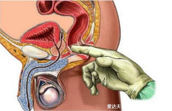 4个最为明显的肠癌信号，大便变细带血不规律都有可能是肠癌