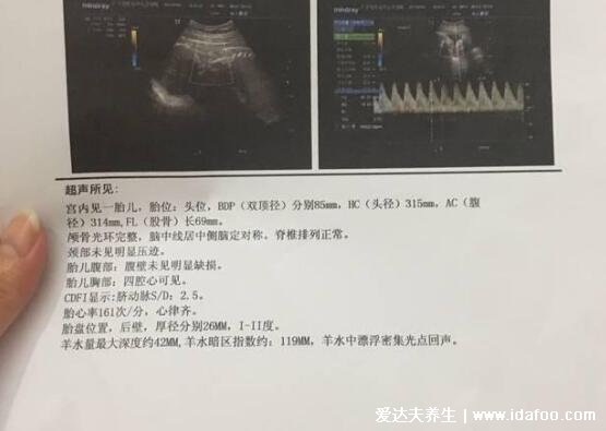 什么提示你怀了男宝宝，占了三个恭喜你怀的是儿子