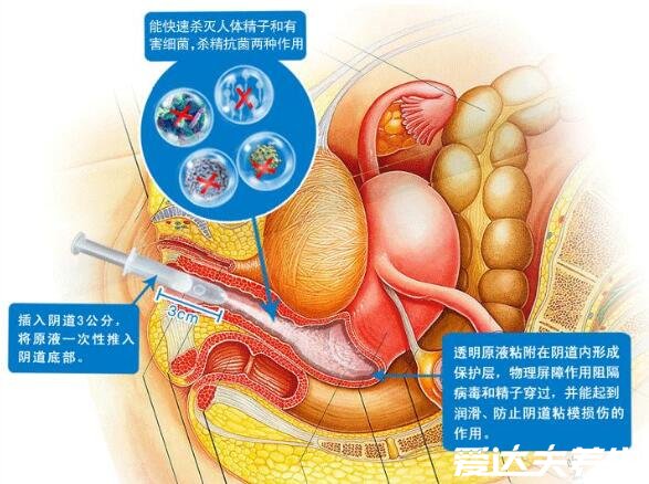 液体避孕套使用方法图解，注射后无需戴套体验感完全不同