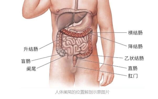 阑尾炎是哪个部位疼，阑尾炎的疼痛位置图片