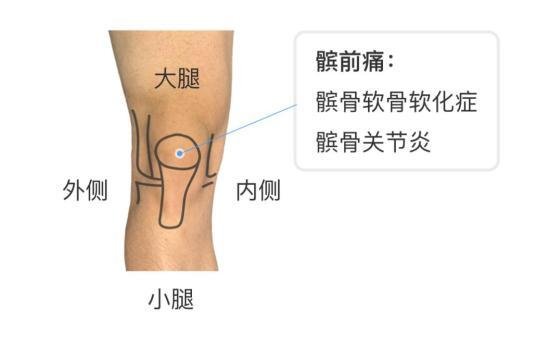 女性膝盖痛的可能问题及预防方法，这三大缘由不仅仅是湿气过重