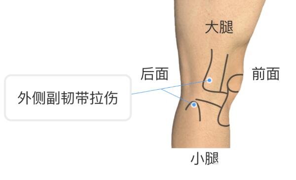 膝盖各个部位疼痛图解，不同位置疼痛代表不同疾病(两侧疼最严重)