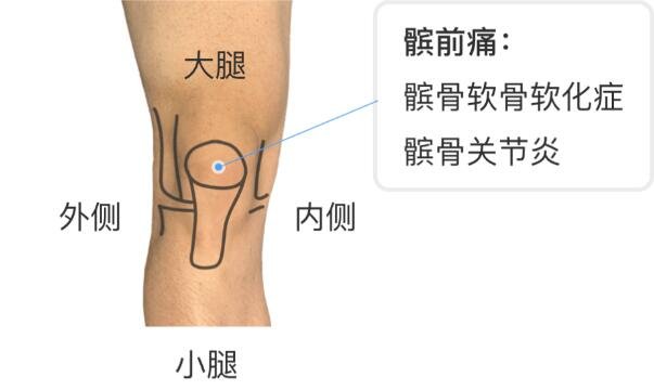 膝盖各个部位疼痛图解，不同位置疼痛代表不同疾病(两侧疼最严重)