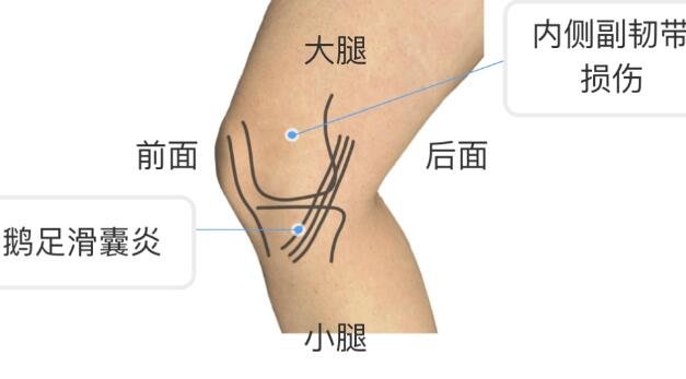 膝盖各个部位疼痛图解，不同位置疼痛代表不同疾病(两侧疼最严重)