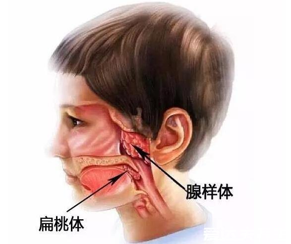 切除腺样体后悔到家了，会导致孩子免疫力下降还容易病症复发