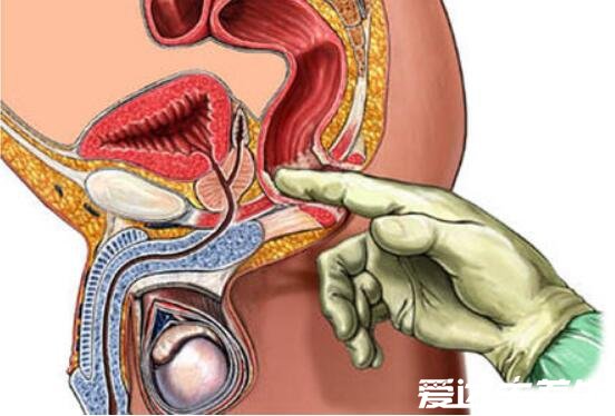 自己按摩前列腺十种手法图解，每天坚持按摩轻松缓解前列腺疾病