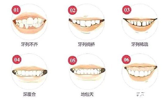 成年以后千万别整牙纯属误导，矫正牙齿随时行但确实需要多注意